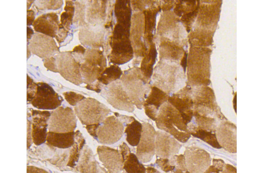 Immunohistochemistry - Anti-GYS1 (phospho S641) Antibody (AP0644) - Antibodies.com