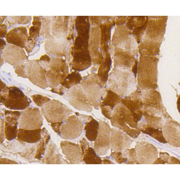 Immunohistochemistry - Anti-GYS1 (phospho S641) Antibody (AP0644) - Antibodies.com