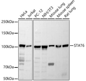 Western Blot - Anti-STAT6 Antibody (A80451) - Antibodies.com