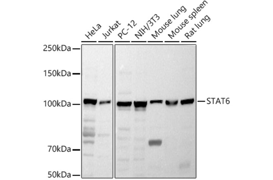 Western Blot - Anti-STAT6 Antibody (A80451) - Antibodies.com