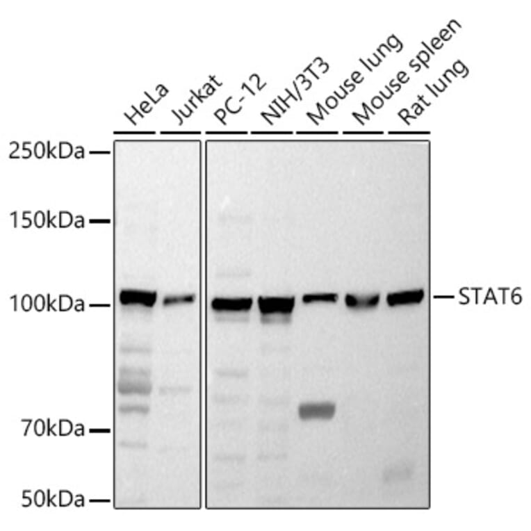 Western Blot - Anti-STAT6 Antibody (A80451) - Antibodies.com