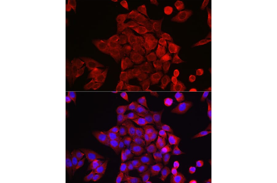 Immunofluorescence - Anti-STAT6 Antibody (A80451) - Antibodies.com