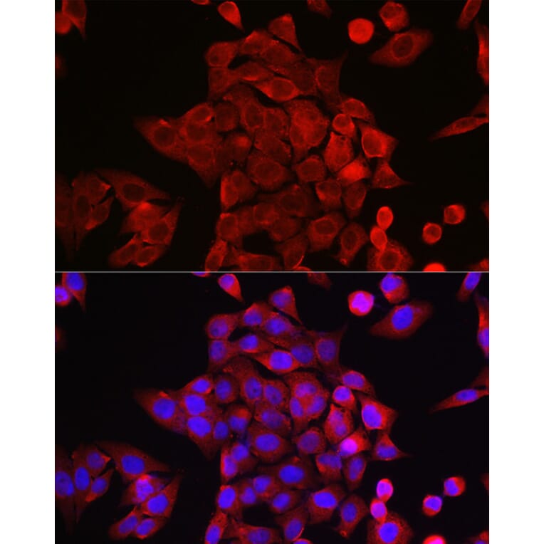 Immunofluorescence - Anti-STAT6 Antibody (A80451) - Antibodies.com