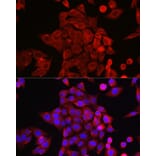 Immunofluorescence - Anti-STAT6 Antibody (A80451) - Antibodies.com