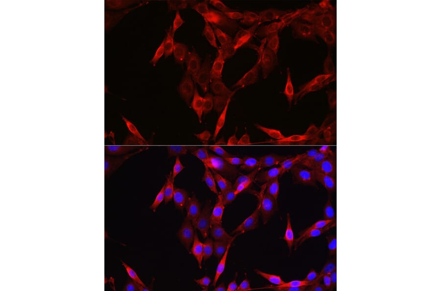 Immunofluorescence - Anti-STAT6 Antibody (A80451) - Antibodies.com