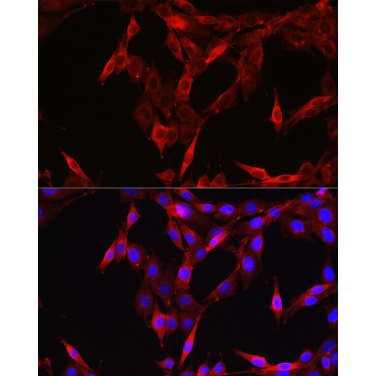 Immunofluorescence - Anti-STAT6 Antibody (A80451) - Antibodies.com