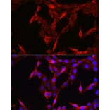 Immunofluorescence - Anti-STAT6 Antibody (A80451) - Antibodies.com