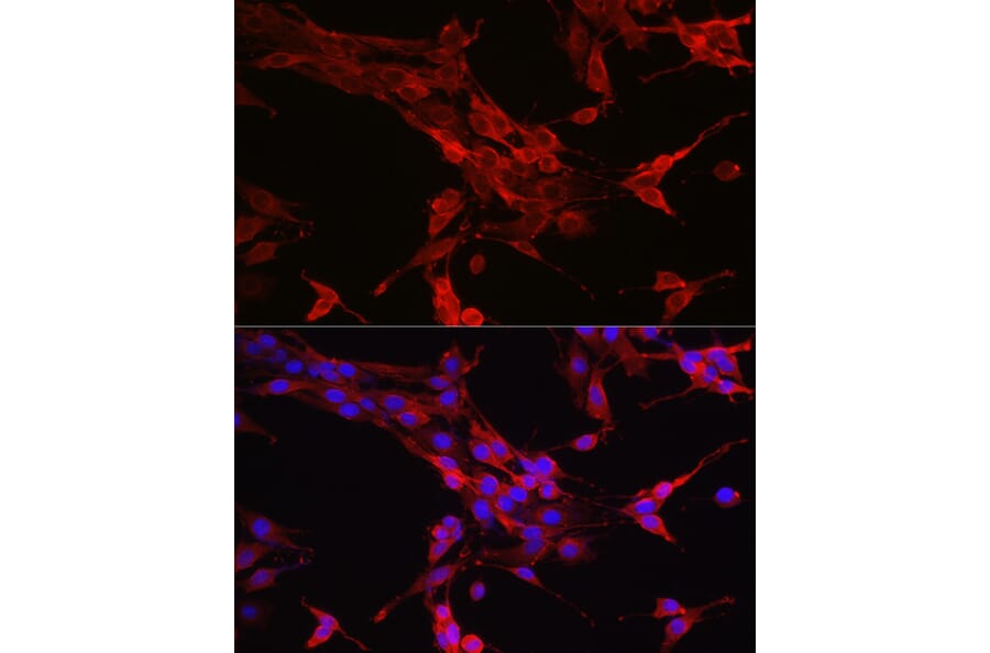 Immunofluorescence - Anti-STAT6 Antibody (A80451) - Antibodies.com