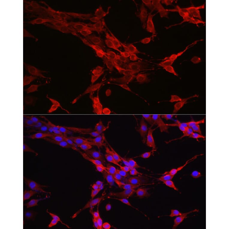 Immunofluorescence - Anti-STAT6 Antibody (A80451) - Antibodies.com