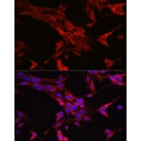 Immunofluorescence - Anti-STAT6 Antibody (A80451) - Antibodies.com