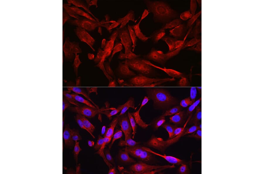 Immunofluorescence - Anti-STAT6 Antibody (A80451) - Antibodies.com