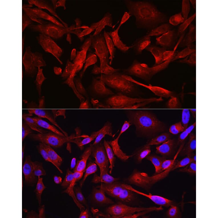 Immunofluorescence - Anti-STAT6 Antibody (A80451) - Antibodies.com