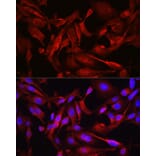 Immunofluorescence - Anti-STAT6 Antibody (A80451) - Antibodies.com