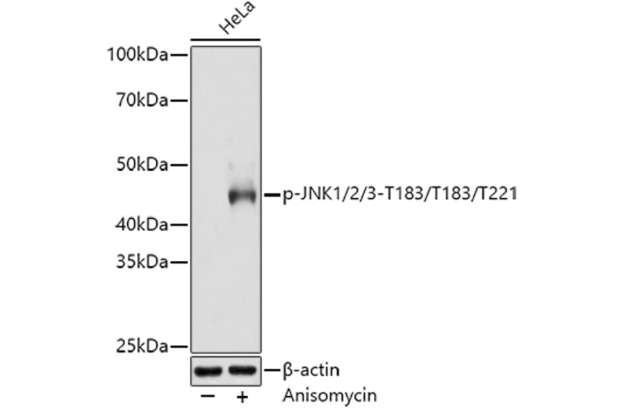 Western Blot - Anti-JNK1 + JNK2 + JNK3 (phospho Thr183 + Thr183 + Thr221) Antibody [ARC0193] (A80452) - Antibodies.com