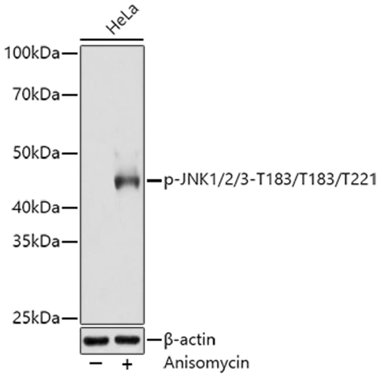 Western Blot - Anti-JNK1 + JNK2 + JNK3 (phospho Thr183 + Thr183 + Thr221) Antibody [ARC0193] (A80452) - Antibodies.com