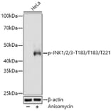 Western Blot - Anti-JNK1 + JNK2 + JNK3 (phospho Thr183 + Thr183 + Thr221) Antibody [ARC0193] (A80452) - Antibodies.com