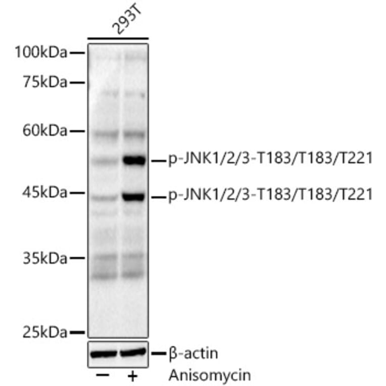 Western Blot - Anti-JNK1 + JNK2 + JNK3 (phospho Thr183 + Thr183 + Thr221) Antibody [ARC0193] (A80452) - Antibodies.com