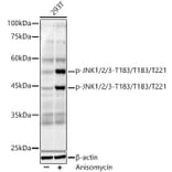 Western Blot - Anti-JNK1 + JNK2 + JNK3 (phospho Thr183 + Thr183 + Thr221) Antibody [ARC0193] (A80452) - Antibodies.com