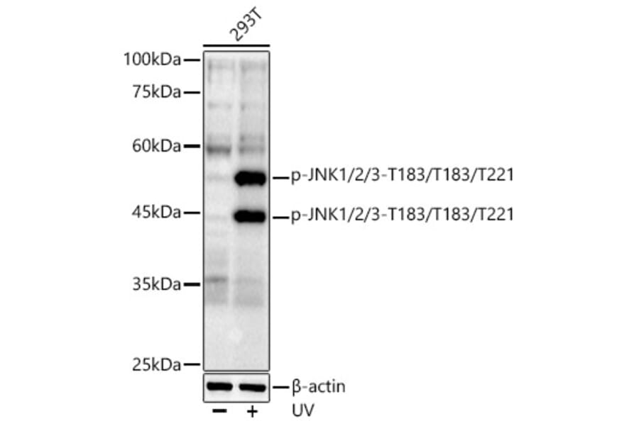 Western Blot - Anti-JNK1 + JNK2 + JNK3 (phospho Thr183 + Thr183 + Thr221) Antibody [ARC0193] (A80452) - Antibodies.com