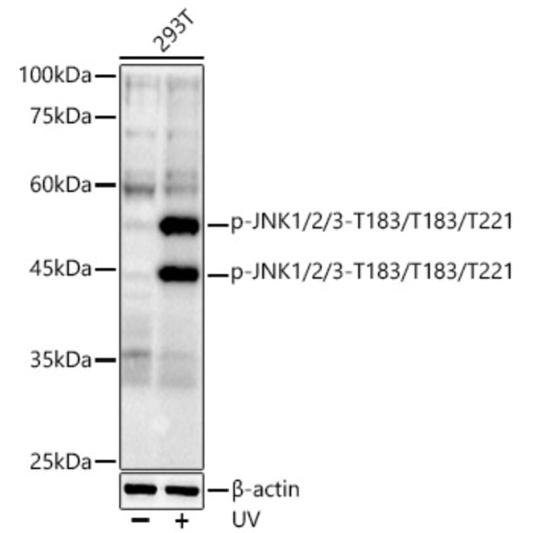 Western Blot - Anti-JNK1 + JNK2 + JNK3 (phospho Thr183 + Thr183 + Thr221) Antibody [ARC0193] (A80452) - Antibodies.com