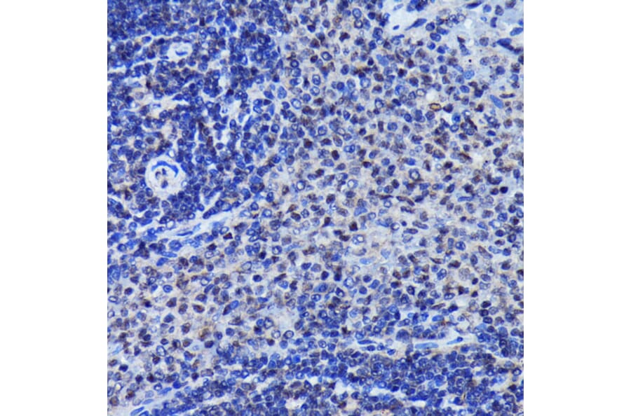 Immunohistochemistry - Anti-JNK1 + JNK2 + JNK3 (phospho Thr183 + Thr183 + Thr221) Antibody [ARC0193] (A80452) - Antibodies.com