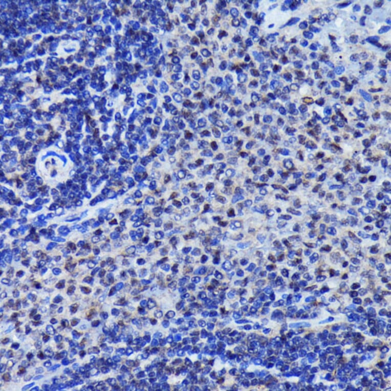 Immunohistochemistry - Anti-JNK1 + JNK2 + JNK3 (phospho Thr183 + Thr183 + Thr221) Antibody [ARC0193] (A80452) - Antibodies.com
