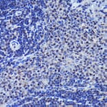 Immunohistochemistry - Anti-JNK1 + JNK2 + JNK3 (phospho Thr183 + Thr183 + Thr221) Antibody [ARC0193] (A80452) - Antibodies.com