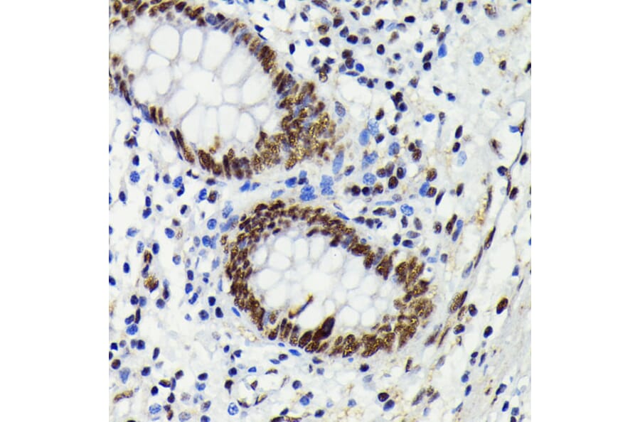 Immunohistochemistry - Anti-JNK1 + JNK2 + JNK3 (phospho Thr183 + Thr183 + Thr221) Antibody [ARC0193] (A80452) - Antibodies.com