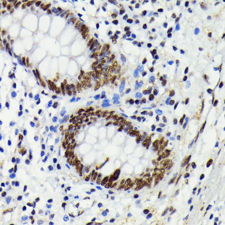 Immunohistochemistry - Anti-JNK1 + JNK2 + JNK3 (phospho Thr183 + Thr183 + Thr221) Antibody [ARC0193] (A80452) - Antibodies.com