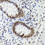 Immunohistochemistry - Anti-JNK1 + JNK2 + JNK3 (phospho Thr183 + Thr183 + Thr221) Antibody [ARC0193] (A80452) - Antibodies.com