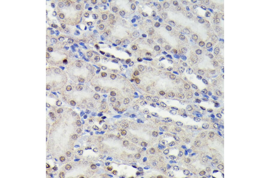 Immunohistochemistry - Anti-JNK1 + JNK2 + JNK3 (phospho Thr183 + Thr183 + Thr221) Antibody [ARC0193] (A80452) - Antibodies.com
