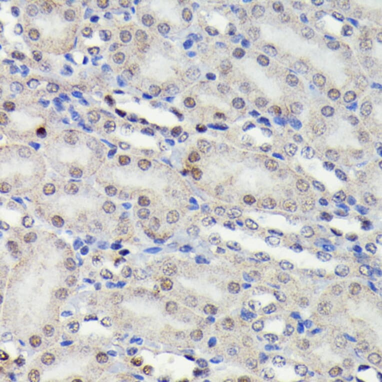 Immunohistochemistry - Anti-JNK1 + JNK2 + JNK3 (phospho Thr183 + Thr183 + Thr221) Antibody [ARC0193] (A80452) - Antibodies.com