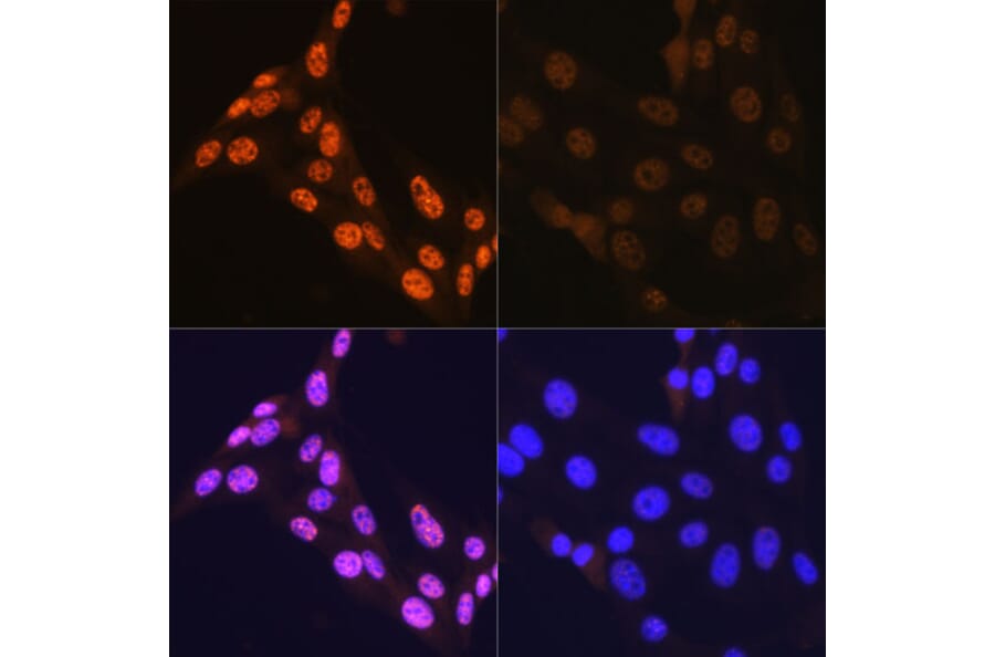 Immunofluorescence - Anti-JNK1 + JNK2 + JNK3 (phospho Thr183 + Thr183 + Thr221) Antibody [ARC0193] (A80452) - Antibodies.com