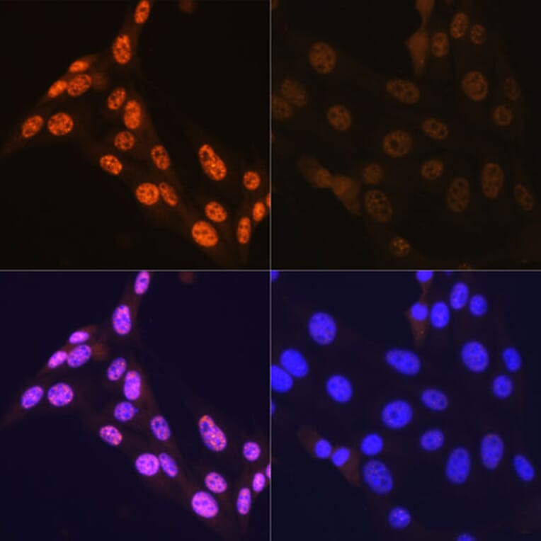 Immunofluorescence - Anti-JNK1 + JNK2 + JNK3 (phospho Thr183 + Thr183 + Thr221) Antibody [ARC0193] (A80452) - Antibodies.com
