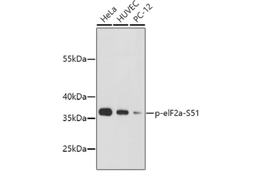 Western Blot - Anti-eIF2α (phospho S51) Antibody (AP0635) - Antibodies.com