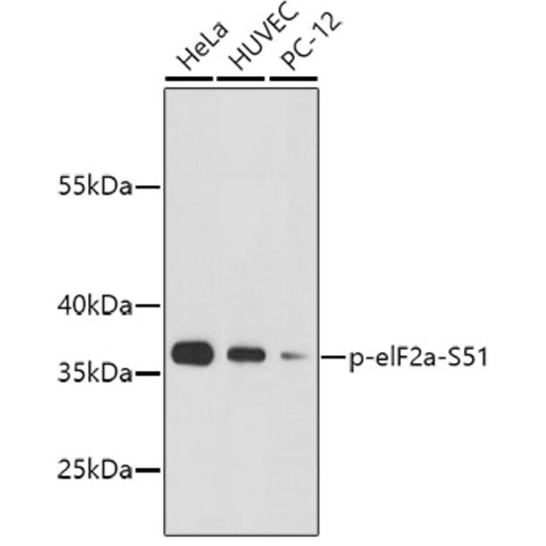 Western Blot - Anti-eIF2α (phospho S51) Antibody (AP0635) - Antibodies.com