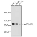 Western Blot - Anti-eIF2α (phospho S51) Antibody (AP0635) - Antibodies.com
