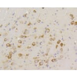 Immunohistochemistry - Anti-eIF2α (phospho S51) Antibody (AP0635) - Antibodies.com