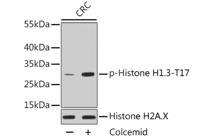 Western Blot - Anti-Histone H1.3 (phospho T17) + Histone H1.4 (phospho T17) Antibody (AP0638) - Antibodies.com