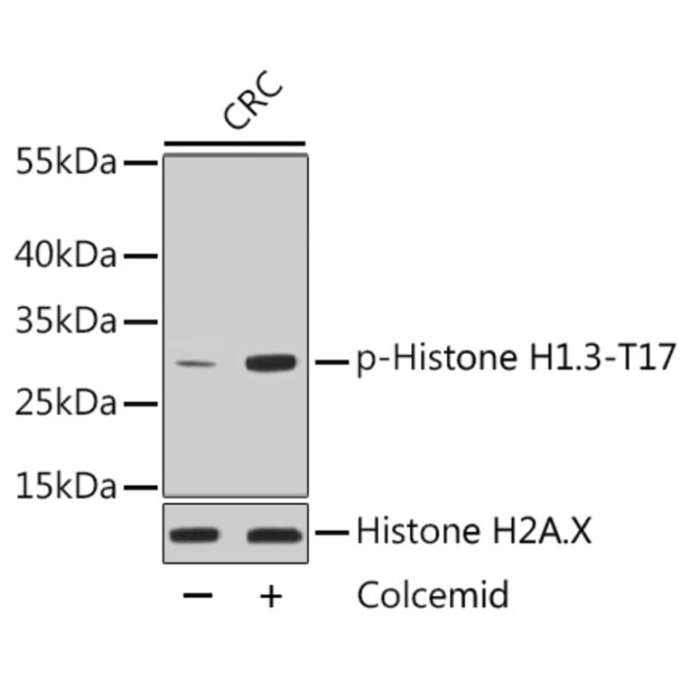 Western Blot - Anti-Histone H1.3 (phospho T17) + Histone H1.4 (phospho T17) Antibody (AP0638) - Antibodies.com