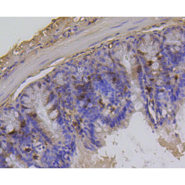 Immunohistochemistry - Anti-Histone H1.3 (phospho T17) + Histone H1.4 (phospho T17) Antibody (AP0638) - Antibodies.com