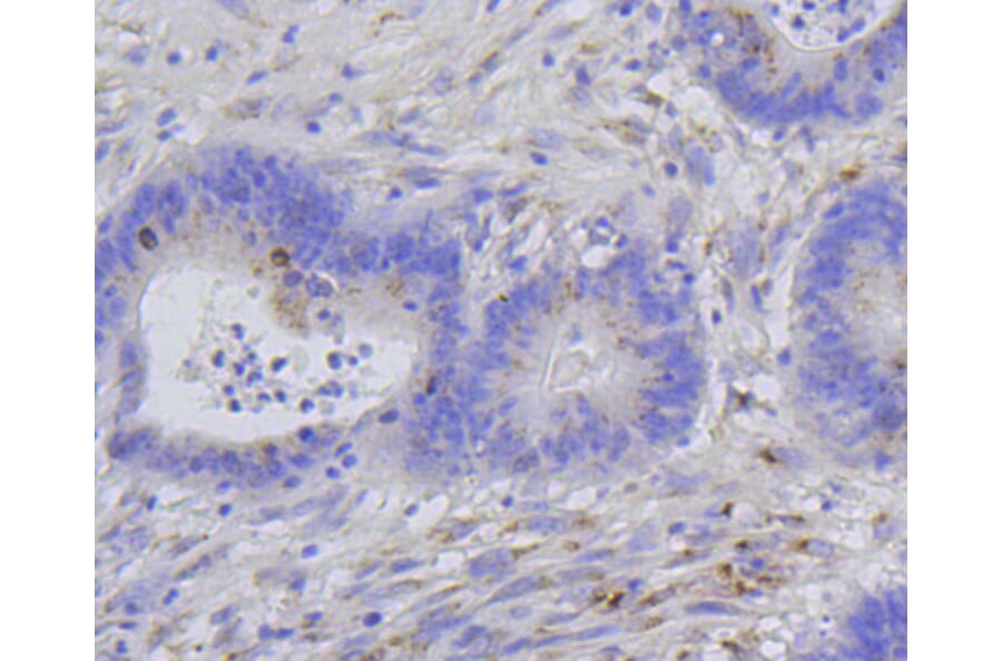 Immunohistochemistry - Anti-Histone H1.3 (phospho T17) + Histone H1.4 (phospho T17) Antibody (AP0638) - Antibodies.com