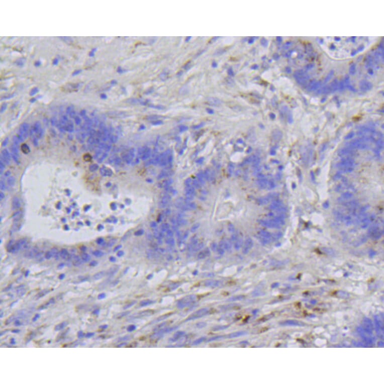 Immunohistochemistry - Anti-Histone H1.3 (phospho T17) + Histone H1.4 (phospho T17) Antibody (AP0638) - Antibodies.com