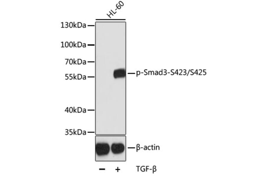 Western Blot - Anti-Smad3 (phospho S423 + S425) Antibody (AP0630) - Antibodies.com