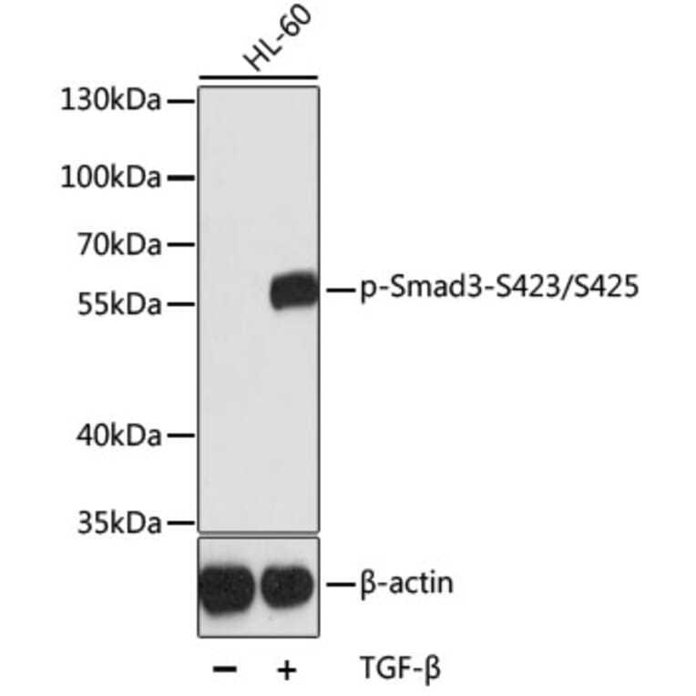 Western Blot - Anti-Smad3 (phospho S423 + S425) Antibody (AP0630) - Antibodies.com