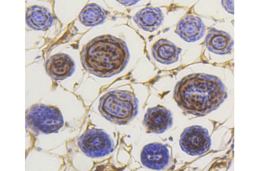 Immunohistochemistry - Anti-Smad3 (phospho S423 + S425) Antibody (AP0630) - Antibodies.com