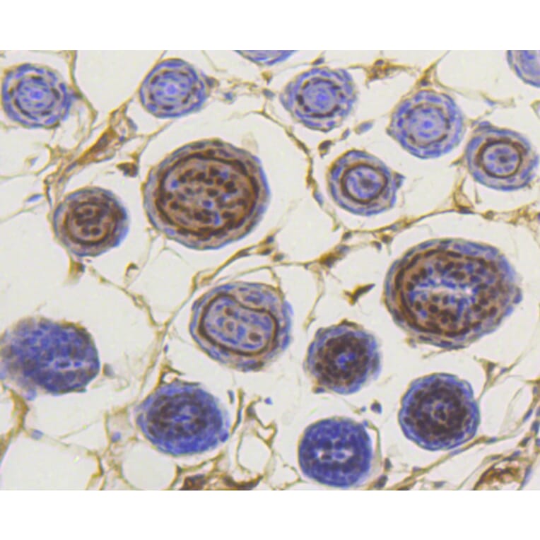 Immunohistochemistry - Anti-Smad3 (phospho S423 + S425) Antibody (AP0630) - Antibodies.com