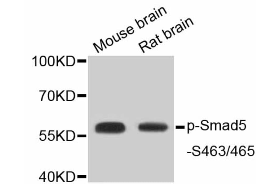 Western Blot - Anti-Smad5 (phospho S463 + S465) Antibody (AP0629) - Antibodies.com