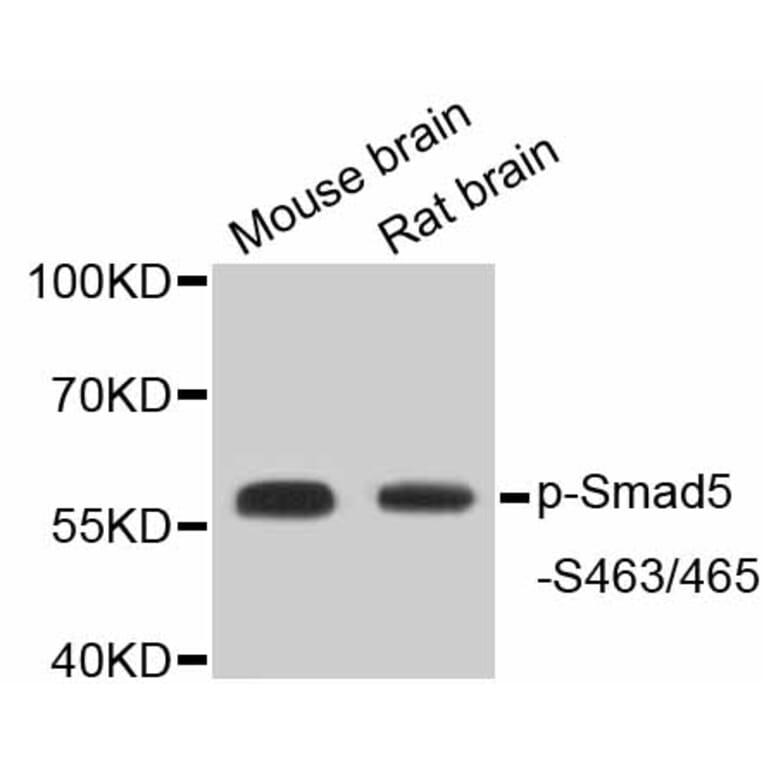Western Blot - Anti-Smad5 (phospho S463 + S465) Antibody (AP0629) - Antibodies.com