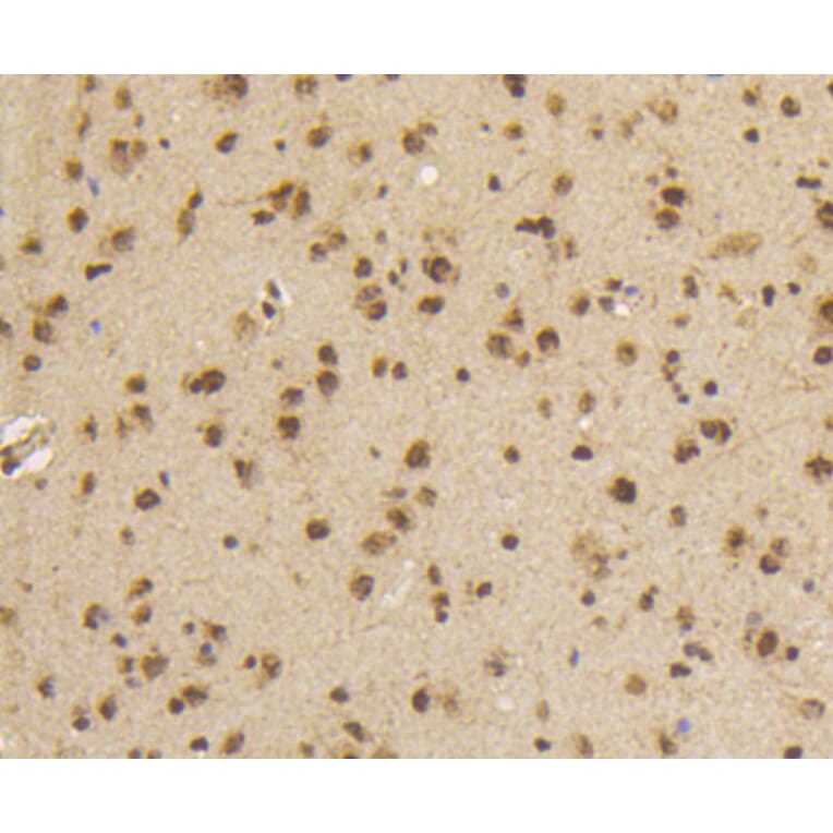 Immunohistochemistry - Anti-Smad5 (phospho S463 + S465) Antibody (AP0629) - Antibodies.com